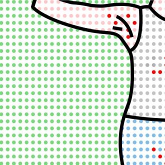 Acne Inversa